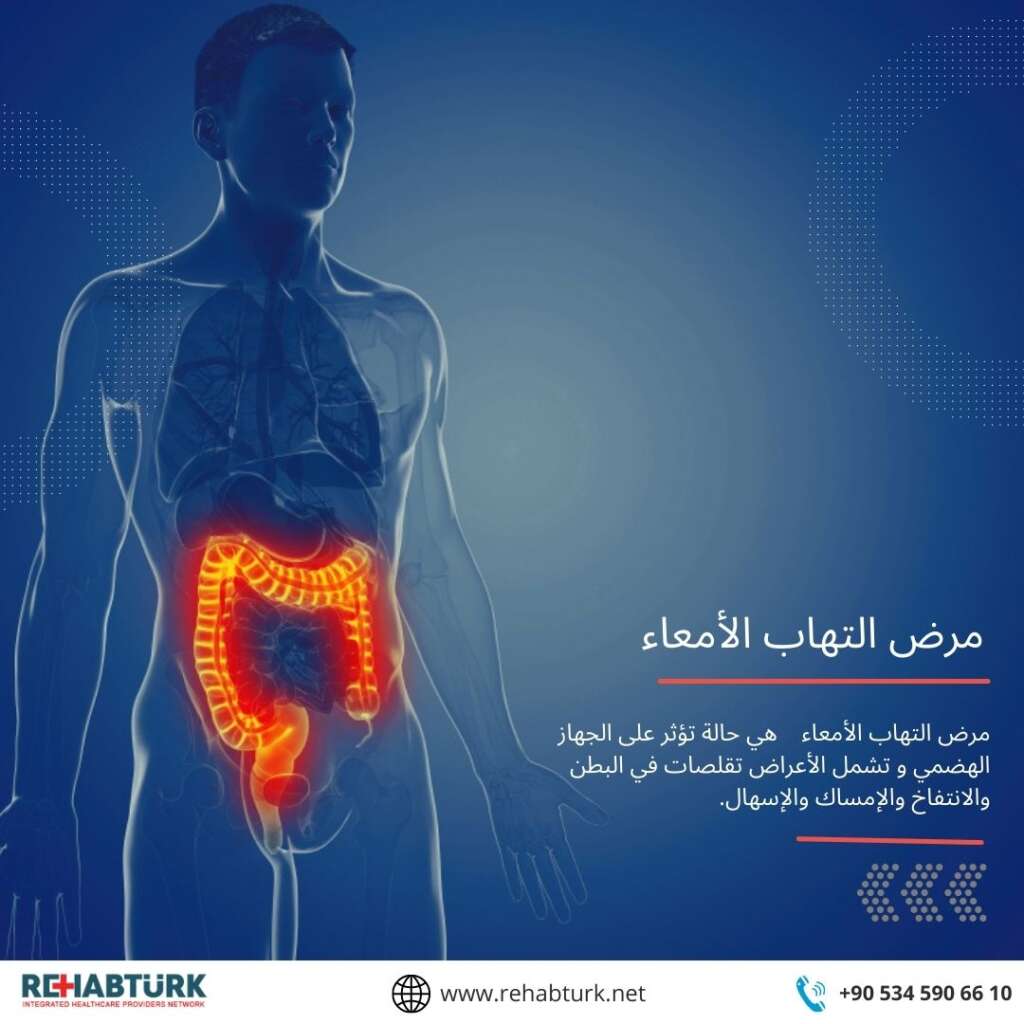 مرض التهاب الأمعاء 