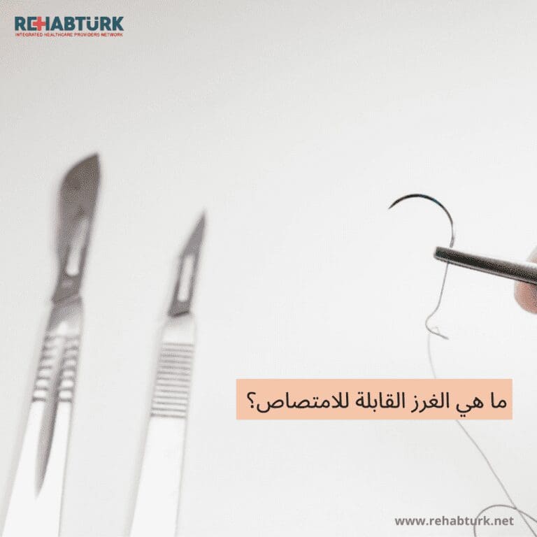ما هي الغرز القابلة للامتصاص