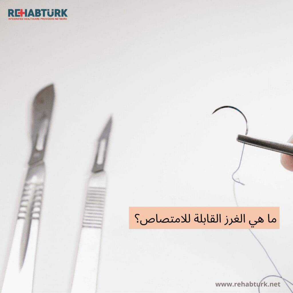 ما هي الغرز القابلة للامتصاص الغرز القابلة للامتصاص ما هي الغرز القابلة للامتصاص