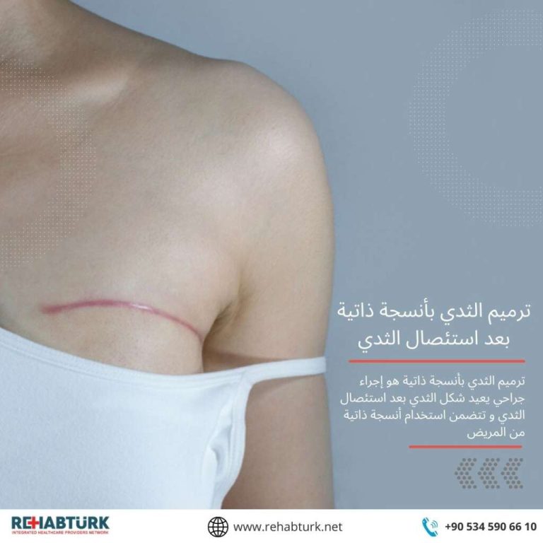 الثدي بأنسجة ذاتية بعد استئصال الثدي 1024x1024 1