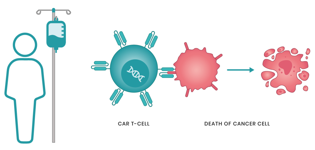 العلاج الخلوي التكيفي: CAR-T-Cell لعلاج السرطان