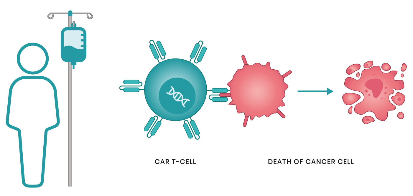 العلاج الخلوي التكيفي: CAR-T-Cell لعلاج السرطان