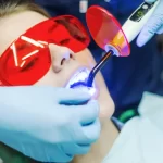 معالجة الأسنان بالليزر 2022