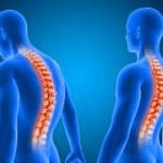 علاج اعوجاج العمود الفقري