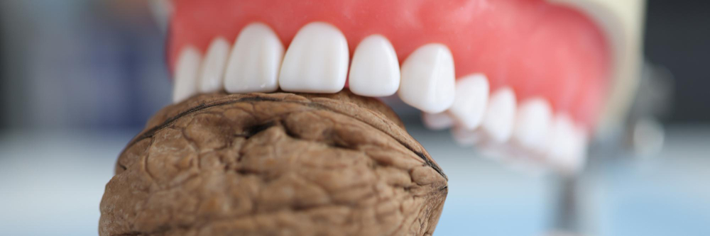 ما هو ربط الأسنان التجميلي؟