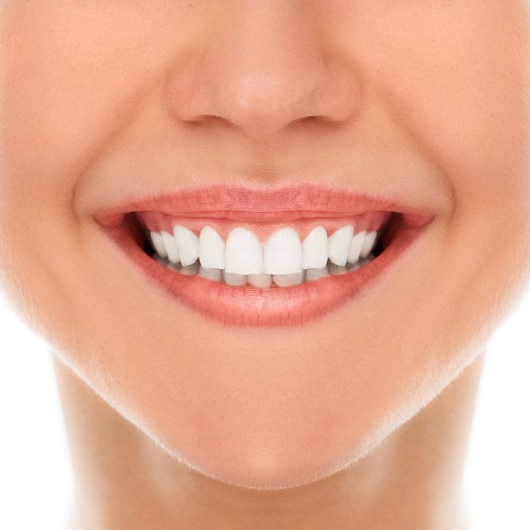ما هو اللومينير للأسنان؟