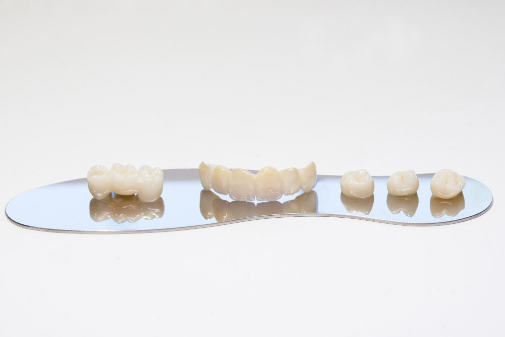 الجسر المتحرك للأسنان | الانواع والفوائد