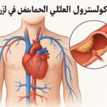 ارتفاع الكولسترول