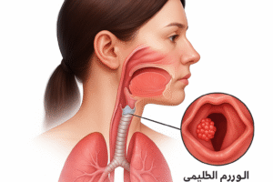 الورم الحليمي التنفسي